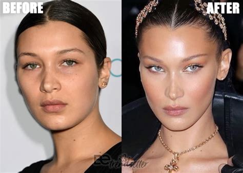 gigi hadid plastic surgery|Bella Hadid on Her Plastic Surgery History and Being。